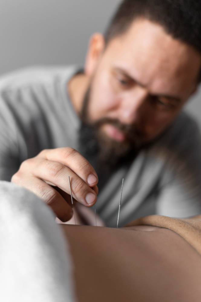 Conditions We Treat with Dry Needling in Asheville